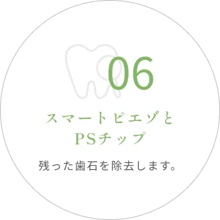 06｜スマートピエゾとPSチップ｜残った歯石を除去します。